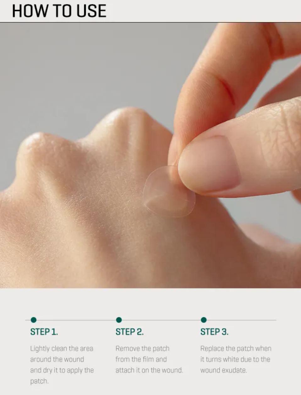 SOME BY MI-30 DAYS MIRACLE CLEAR SPOT PATCH